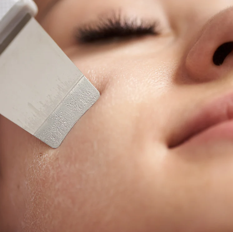 Ultrasonic Skin Scrubber – Deep Pore Cleaner & Blackhead Remover